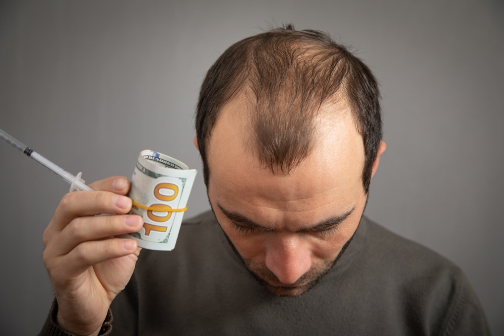 Which Country Has Cheapest Hair Transplant?