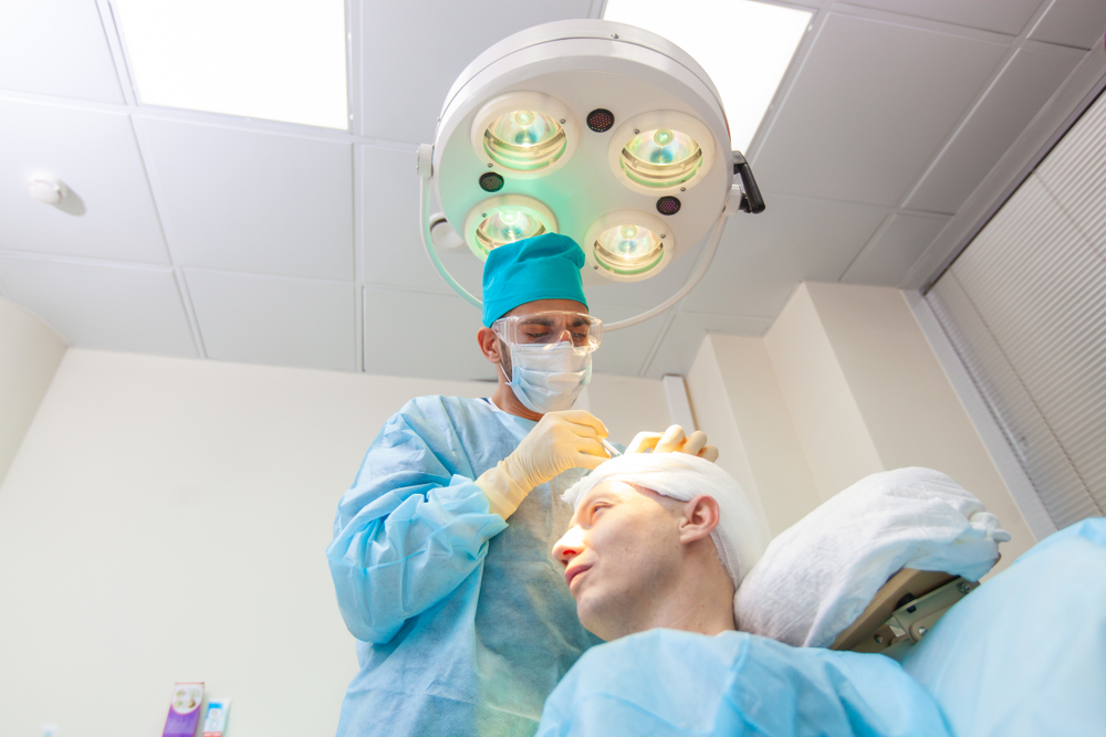 How Much Is 5000 Grafts Hair Transplant In United States?