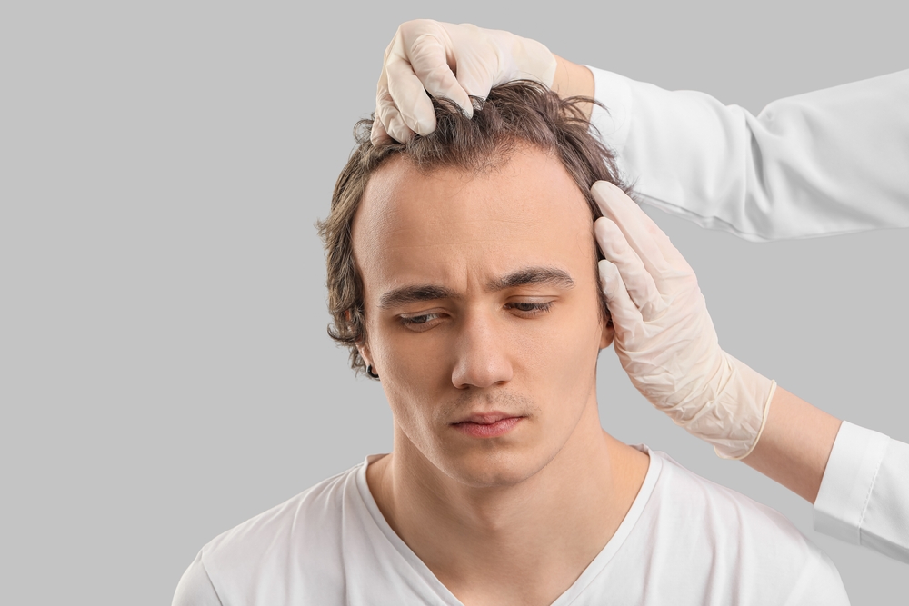 Why Hair Transplants Aren't Worth It