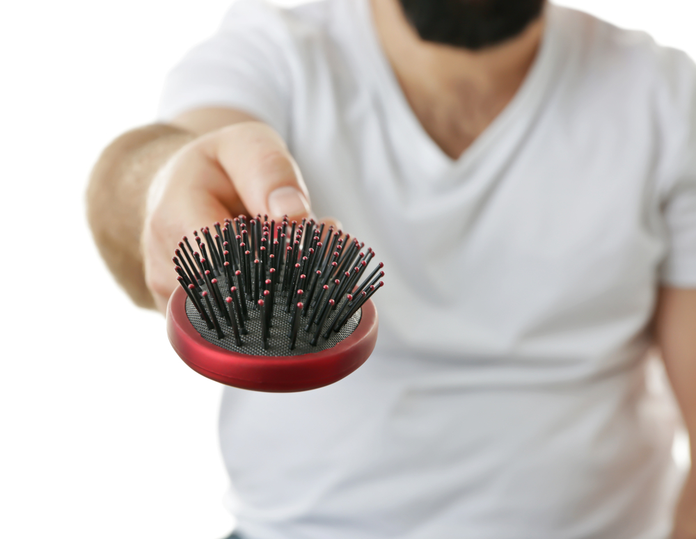 Can I Brush My Hair After 3 Months Of Hair Transplant