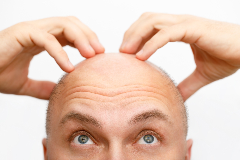 Can I Touch My Hair 7 Days After Hair Transplant